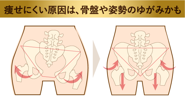 痩せにくい原因は、骨盤や姿勢のゆがみかも